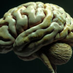 La DÉGÉNÉRESCENCE CORTICO BASALE: Un défi Médical et Scientifique